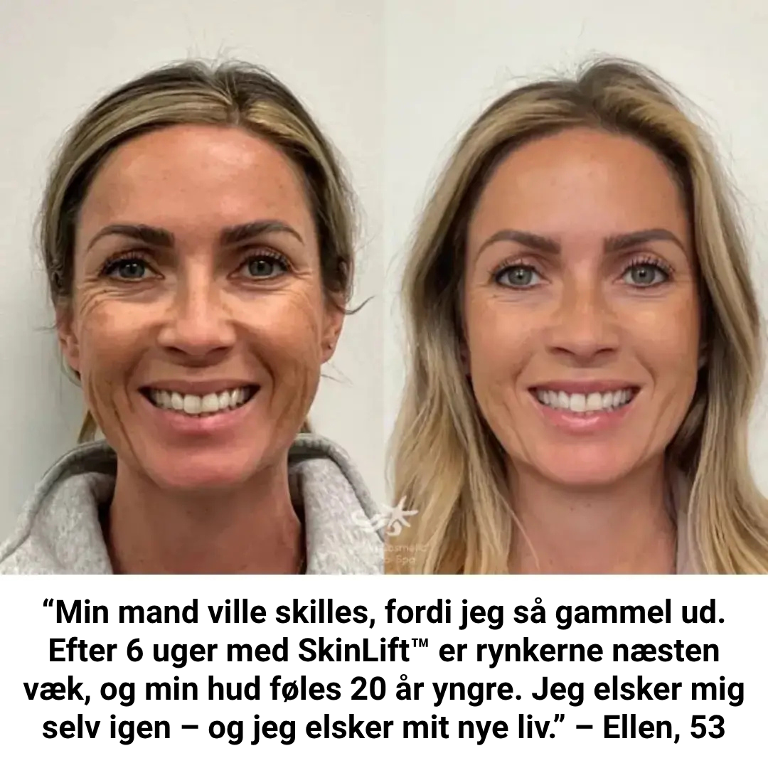SkinLiftCare™ Botox Serum - Synligt yngre hud på 14 dage.