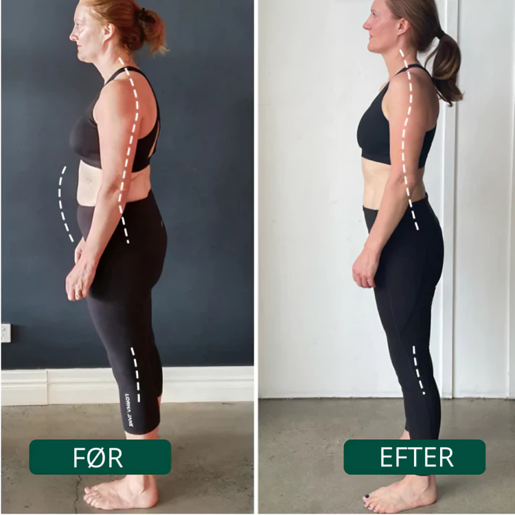 Postura™ - Lindrer rygsmerter og forbedrer kropsholdningen