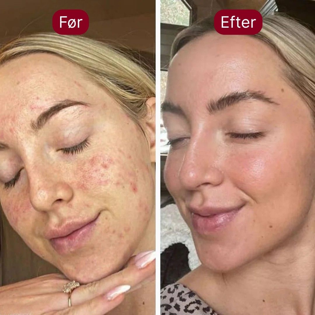 DermaSkin™ Serum Duo - Silkeblød hud på få sekunder