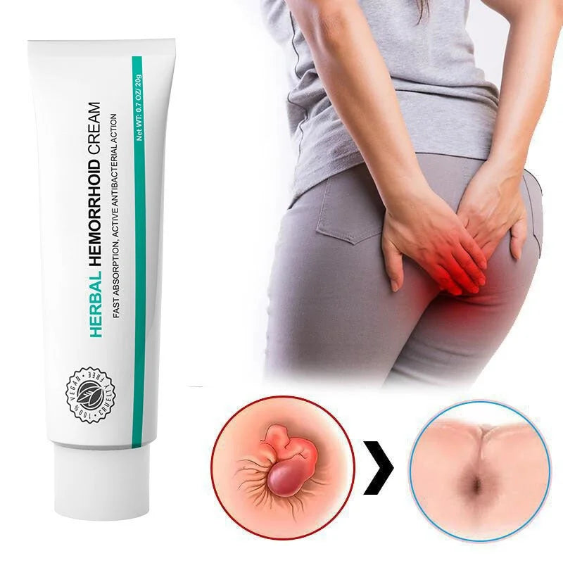 NovaHerbalCream™ | Hurtig, naturlig lindring mod hæmorider – mærkbar forbedring inden for 24 timer