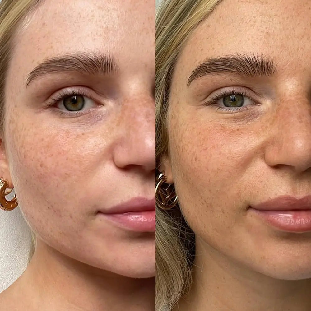 SunnyGlow™ – Naturlig glød uden solen