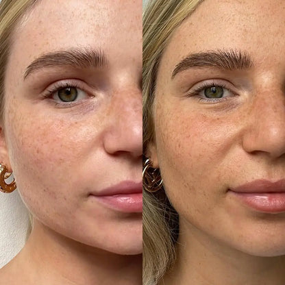 SunnyGlow™ – Naturlig glød uden solen