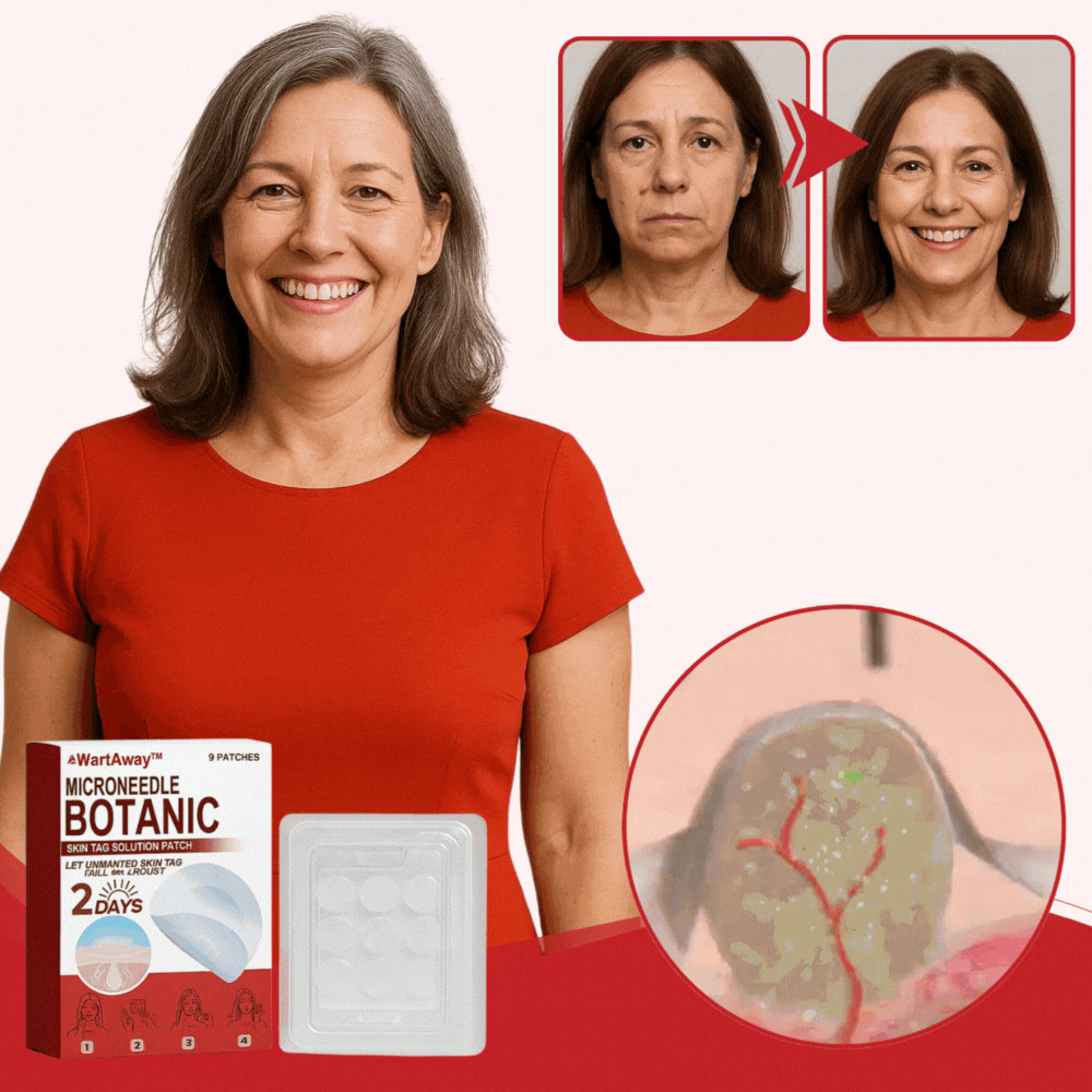 WartsAwayPatch™ – Fjern Vorter & Hudflapper på 48 Timer – Uden Smerte!