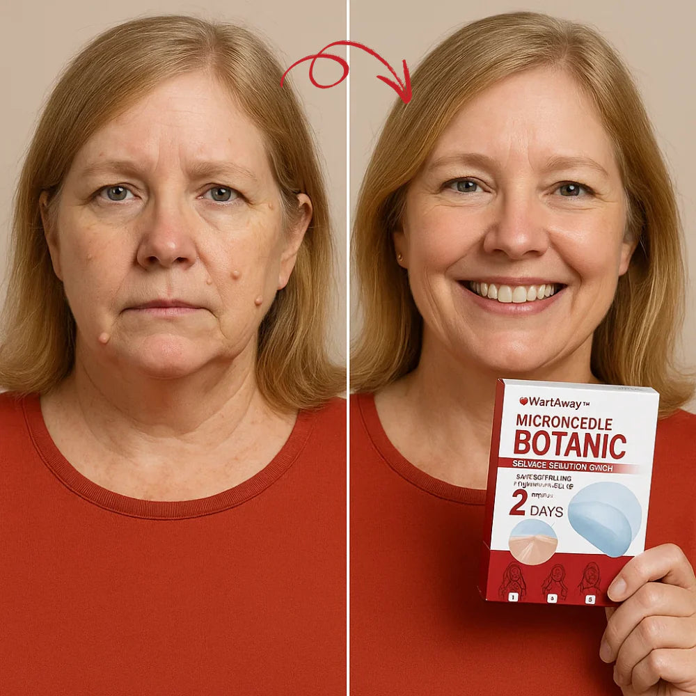 WartsAwayPatch™ – Fjern Vorter & Hudflapper på 48 Timer – Uden Smerte!