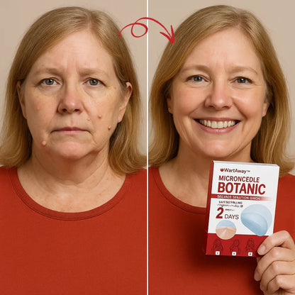 WartsAwayPatch™ – Fjern Vorter & Hudflapper på 48 Timer – Uden Smerte!