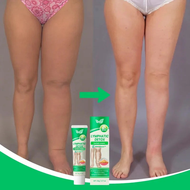 SwellEase™ – Naturlig lindring mod hævede ben, ankler og fødder