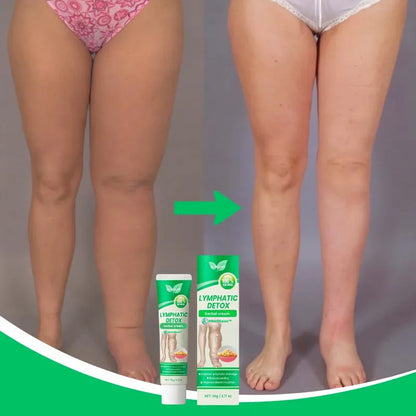 SwellEase™ – Naturlig lindring mod hævede ben, ankler og fødder