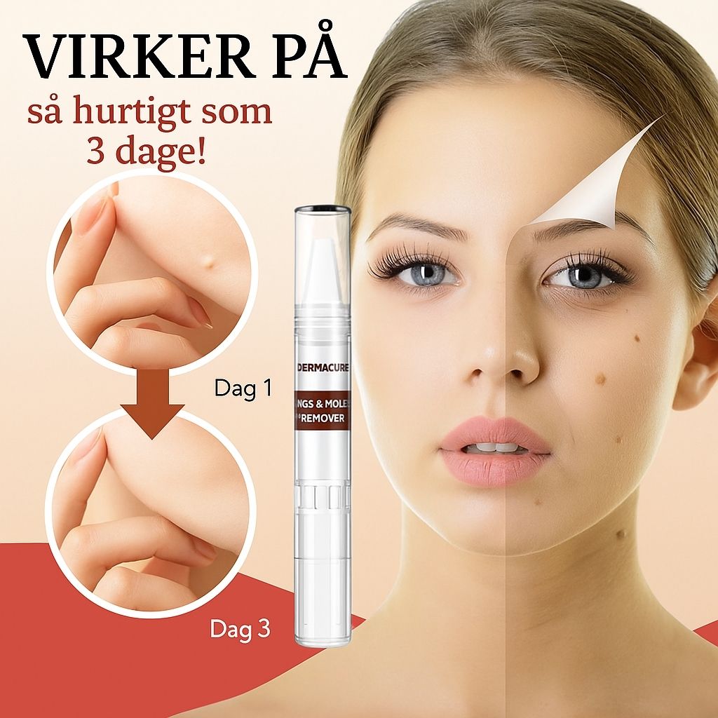 DermaCure™ | Fjerner vorter og alderspletter – smertefrit inden for 3 dage!