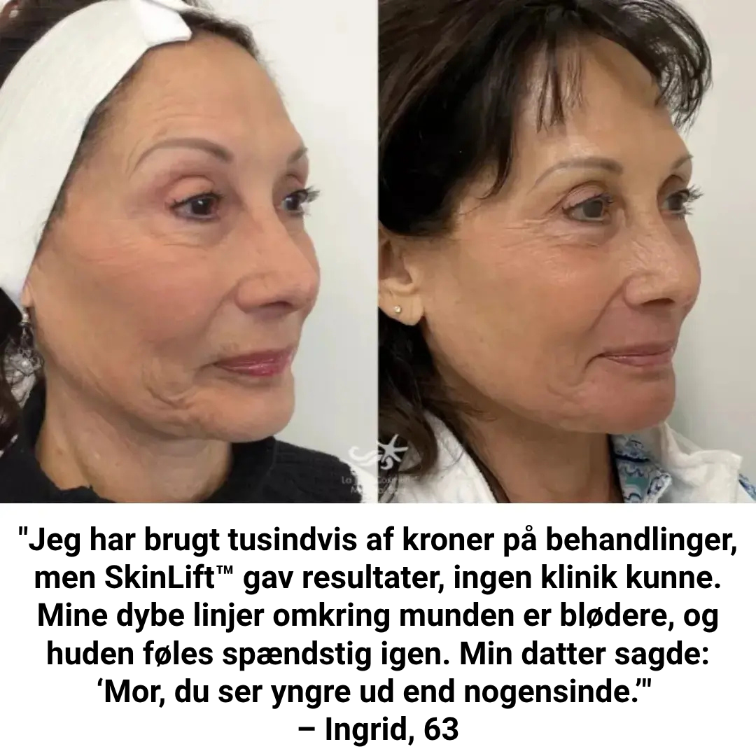 SkinLiftCare™ Botox Serum - Synligt yngre hud på 14 dage.