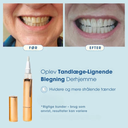 PearlWhite™ – Tandblegningspen – 35% carbamidperoxid-formel