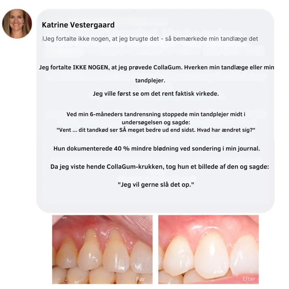 CollaGum™ | Styrk dit tandkød indefra og bevar dit naturlige smil
