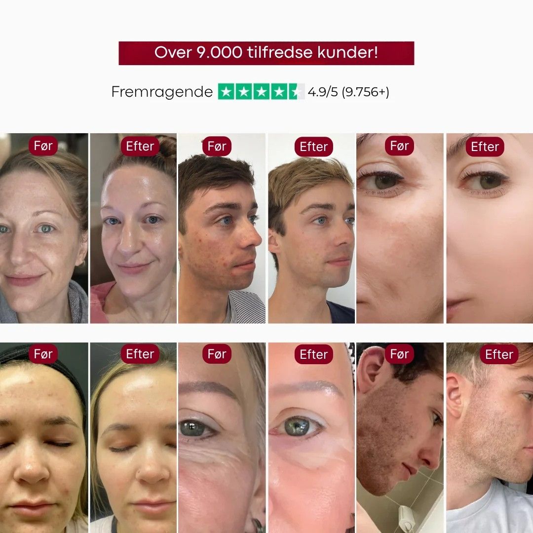 DermaSkin™ Serum Duo - Silkeblød hud på få sekunder