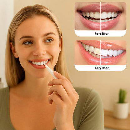 Strålende Smil™ – Klinik-inspireret tandblegning til hjemmebrug