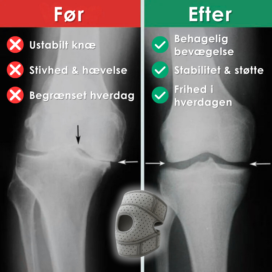 OrthoKneeCup Pro™ – For en hverdag uden knæsmerter
