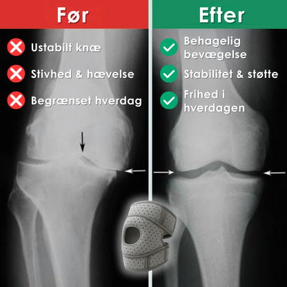 OrthoKneeCup Pro™ – For en hverdag uden knæsmerter