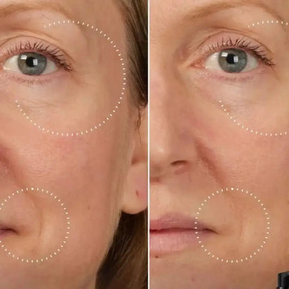SkinLiftCare™ Botox Serum - Synligt yngre hud på 14 dage.