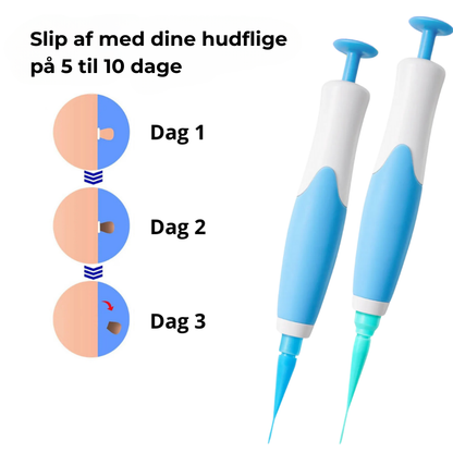 ClearSkin™ Pen – Sikker fjernelse af hudmærker!