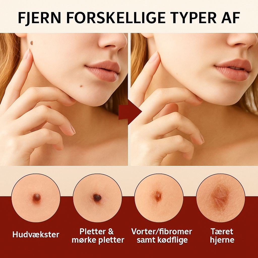 DermaCure™ | Fjerner vorter og alderspletter – smertefrit inden for 3 dage!