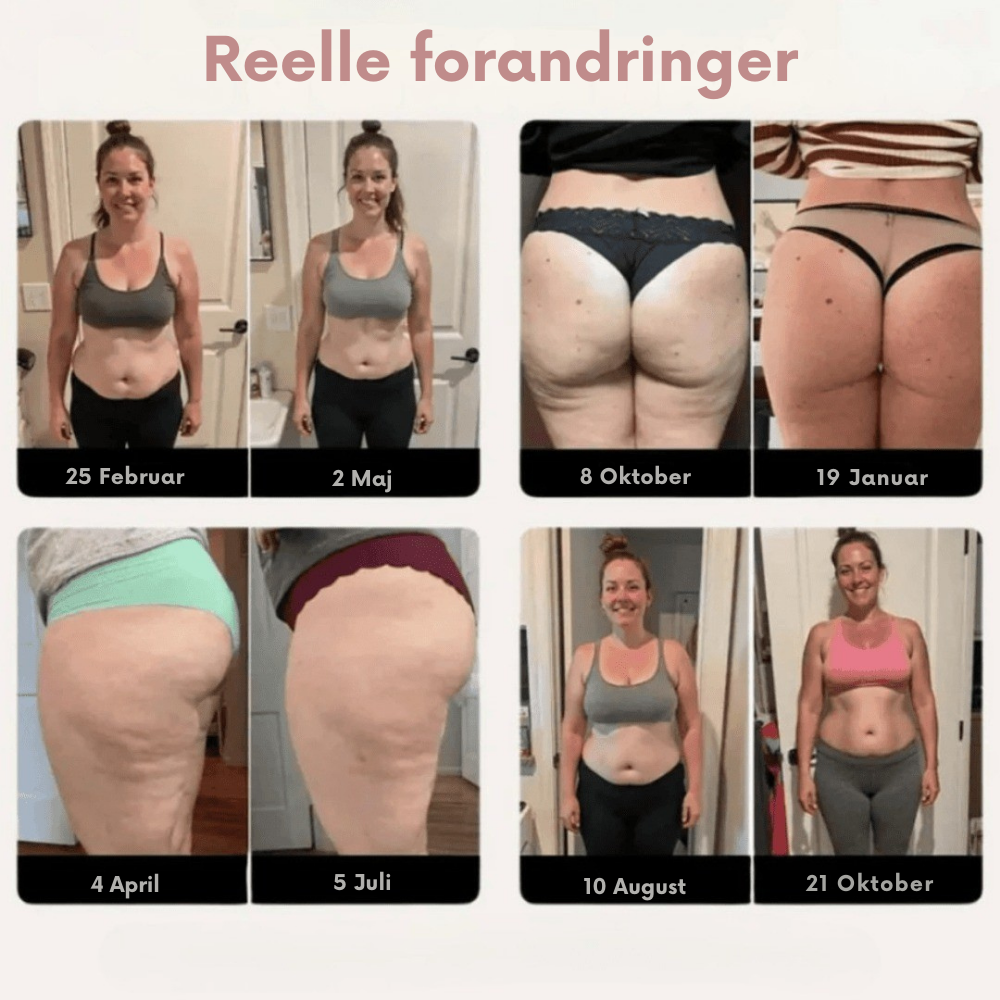 SculptWear Tights™ | Sportsleggings der gør cellulite usynlig