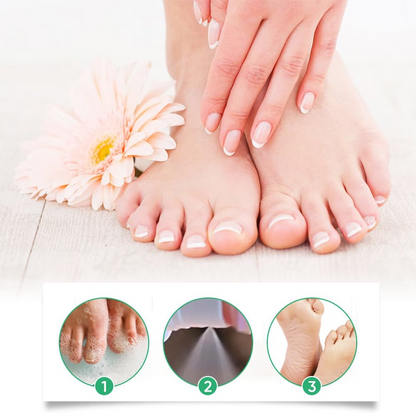 FootCare Spray 1+1 GRATIS: Antimikrobiel Dyb Hydrering Fodpleje Spray