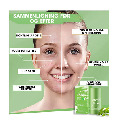 TeaMask® - Dybderensende maske med grøn te - 1+1 GRATIS