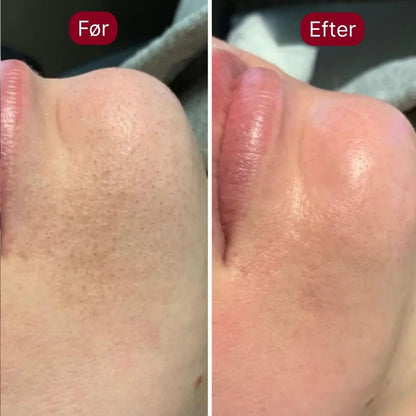 DermaSkin™ Serum Duo - Silkeblød hud på få sekunder