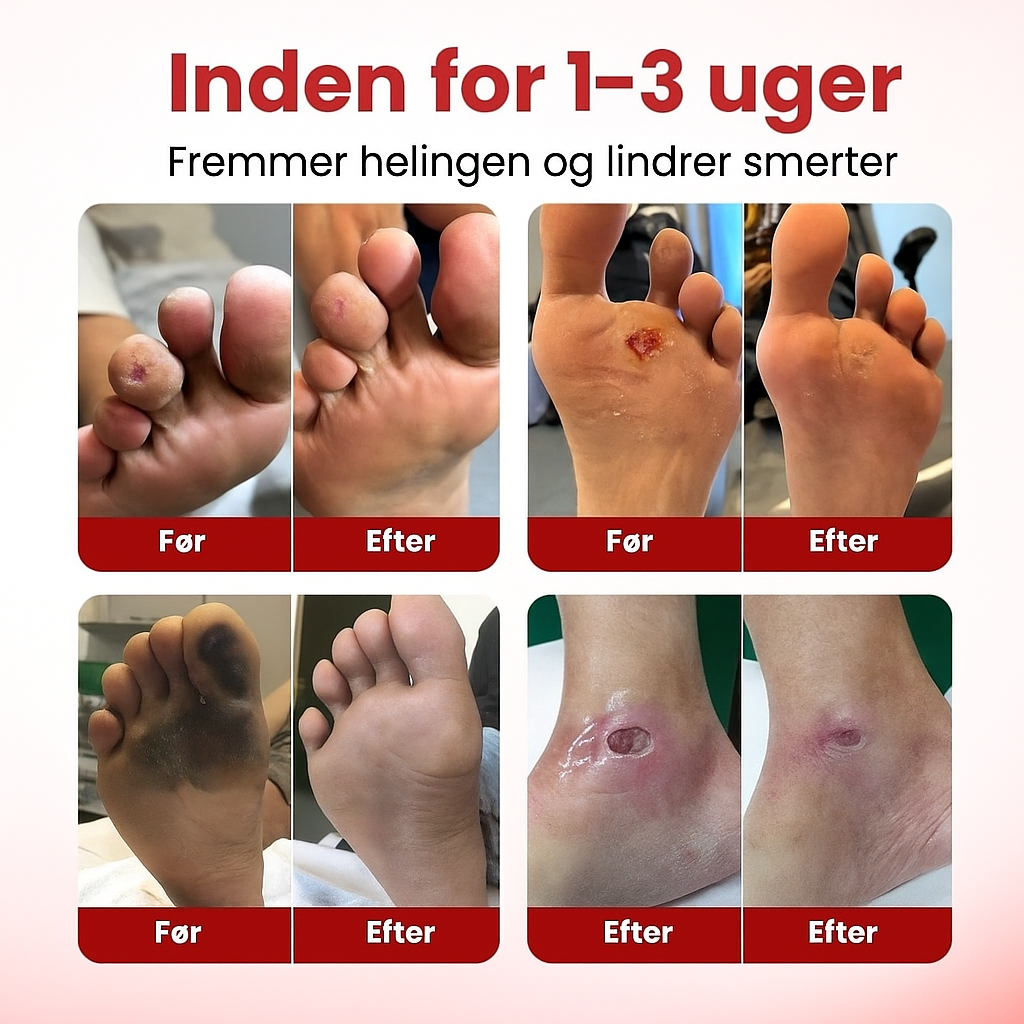 VitaGluco™ | Stop genstridige diabetiske sår og genskab sund hud på få dage