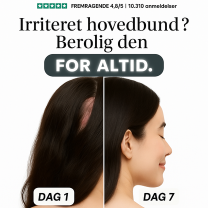 NovaCalm Advance™ – Naturlig lindring for kløende, rød og sensitiv hud
