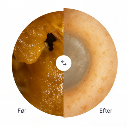 Nova WaxCleaner™ – Smart & Skånsom Ørerens med HD-Præcision