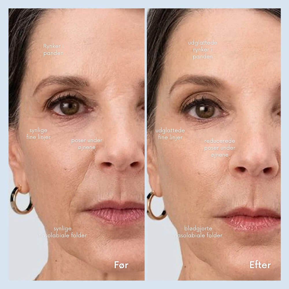 FacialWand Pro™ | Skab en fastere, glattere og mere strålende hud