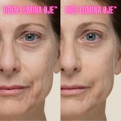 Lumina Øje™ -  Øjeblikkelig løft – uden nåle
