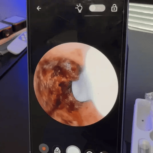 Shoppenhagen™ – Smart ørerens med avanceret teknologi