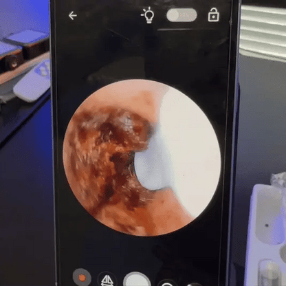 Shoppenhagen™ – Smart ørerens med avanceret teknologi