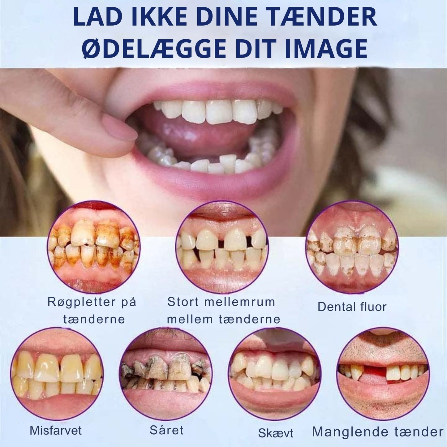 SmileForm™-🦷 Avancerede helproteser (begrænset tilbud ⏰)