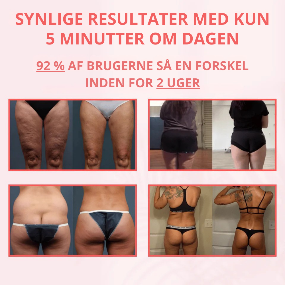CelluSculpt Pro™ | 4-i-1 -massageapparat med cupping, infrarød og varme – reducerer cellulite og strækmærker synligt