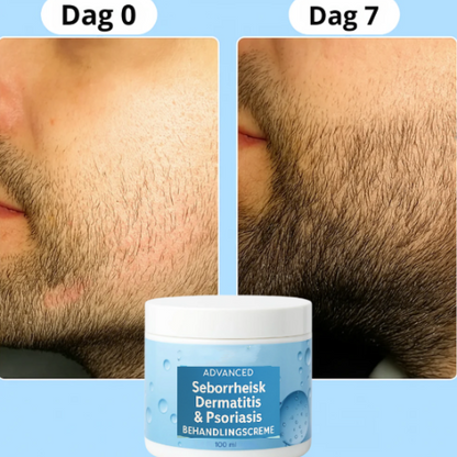 NovaBeardCream™ - For tykkere, fyldigere skæg