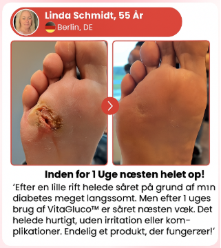 VitaGluco™ | Stop genstridige diabetiske sår og genskab sund hud på få dage