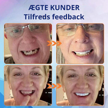 SmileForm™-🦷 Avancerede helproteser (begrænset tilbud ⏰)