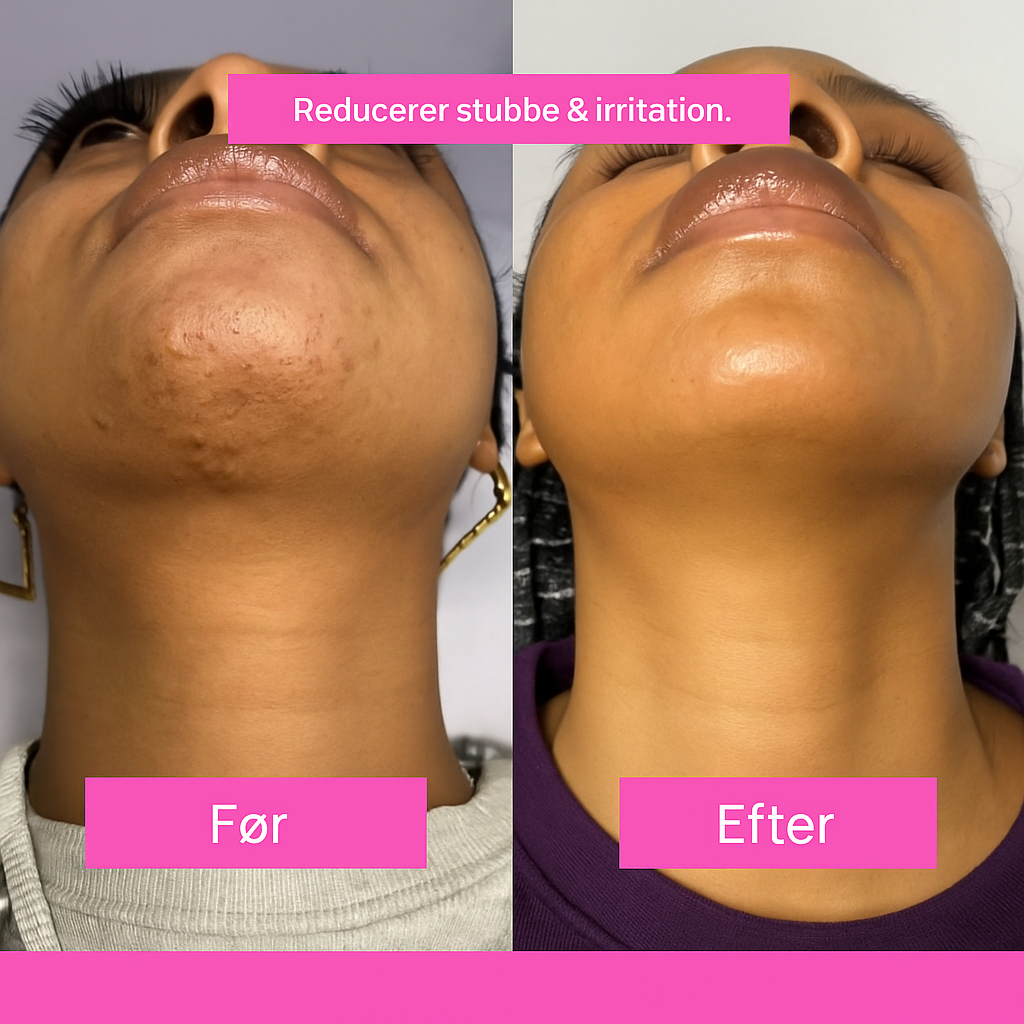 Flawless Hårfjerningsolie – Naturligt glat hud uden barberblad