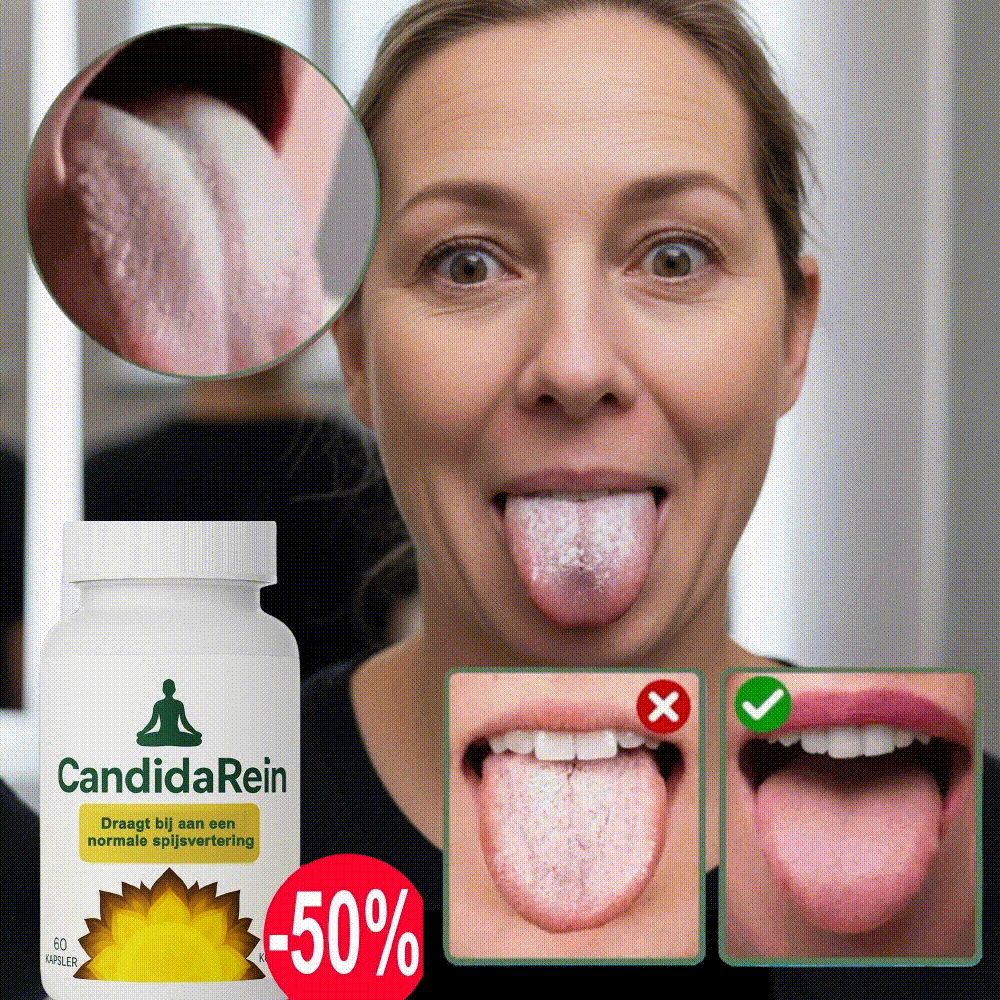 CandidaRein™ | Fjerner hvid belægning på tungen hos 95 % på blot 2 dage!