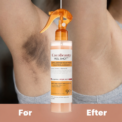 Lumièra – Body Peel Spray med Kojic + Gurkemeje