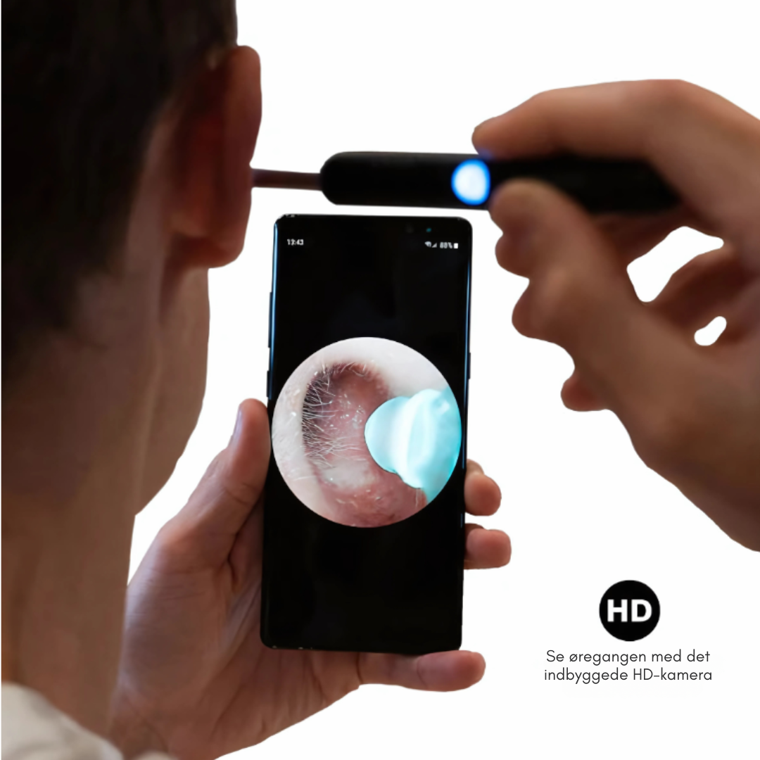 Shoppenhagen™ – Smart ørerens med avanceret teknologi