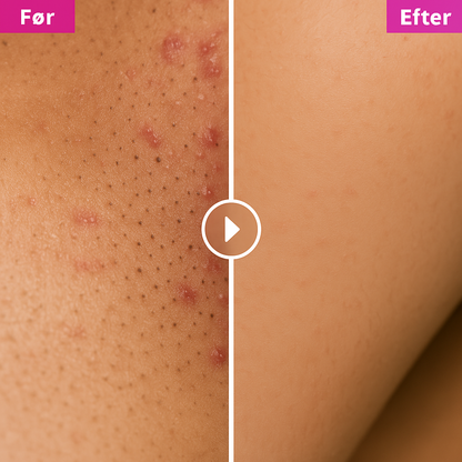 Flawless Hårfjerningsolie – Naturligt glat hud uden barberblad