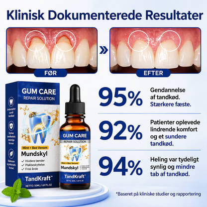 TandKraft™ – Tand- och tandköttsstyrka