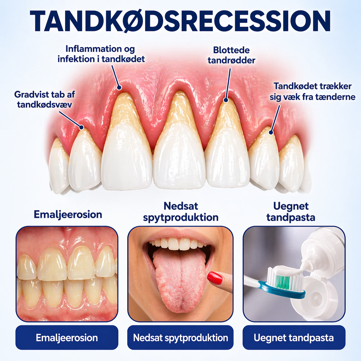 TandKraft™ – Tand- och tandköttsstyrka