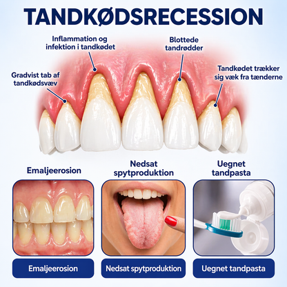 TandKraft™ – Tand- och tandköttsstyrka