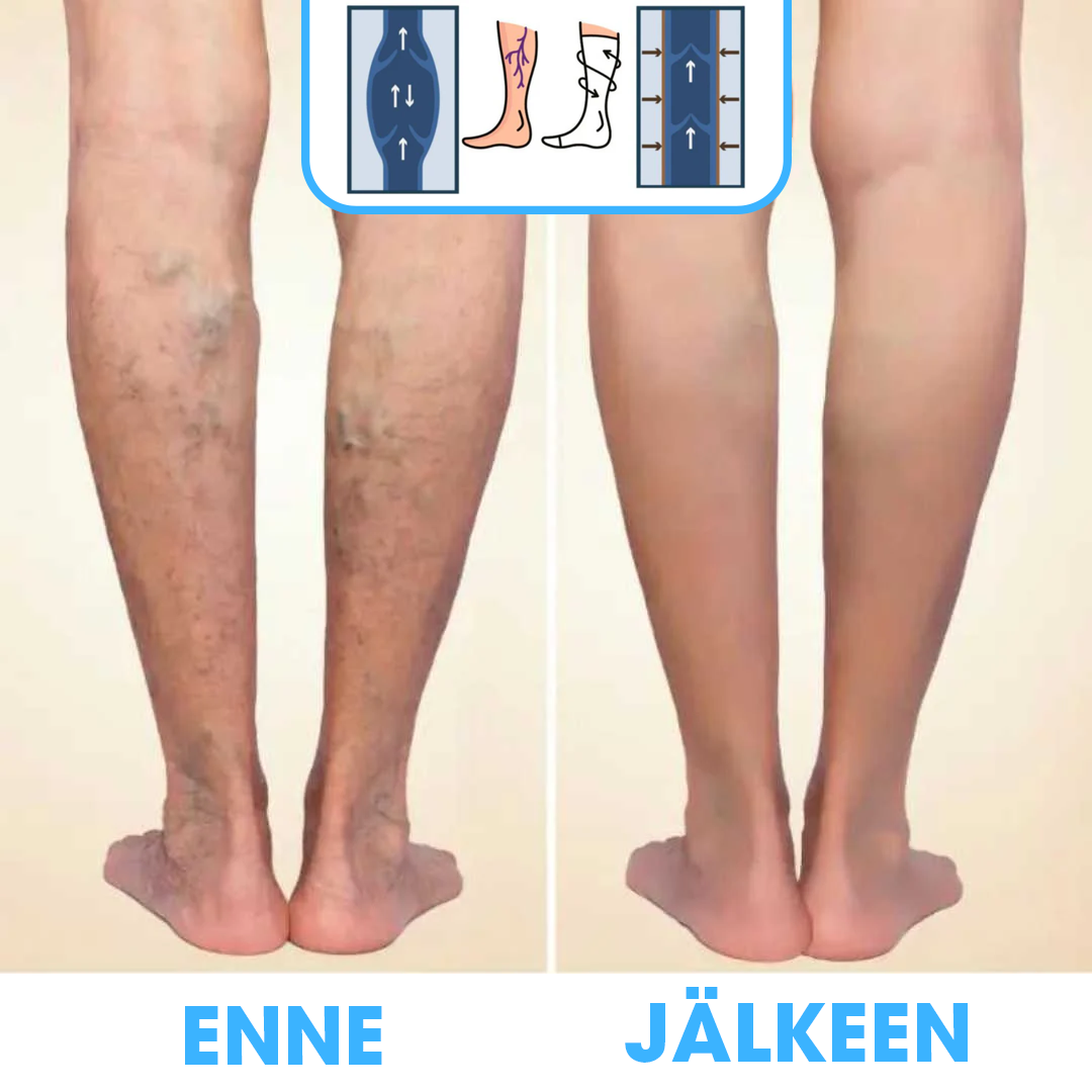 FlowSocks Pro™ - støttestrømper