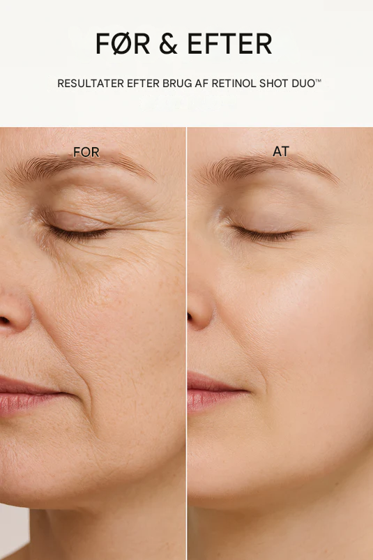 NovaMaxGlow™ Retinol Shot-  strålende hudpositionering.