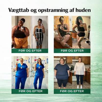 Zycon® Nano Micronålsplåster – 28 dagars metabolismstöd